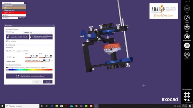 Virtual Articulator -Dr. Adarve смотреть онлайн
