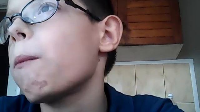 Порезал палец 😭😭😭😭 смотреть онлайн