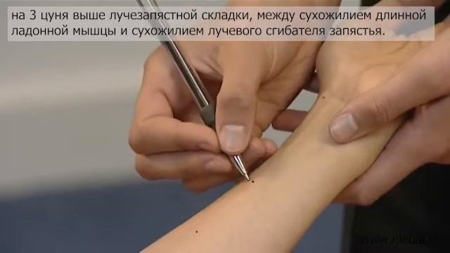 Хорея смотреть онлайн