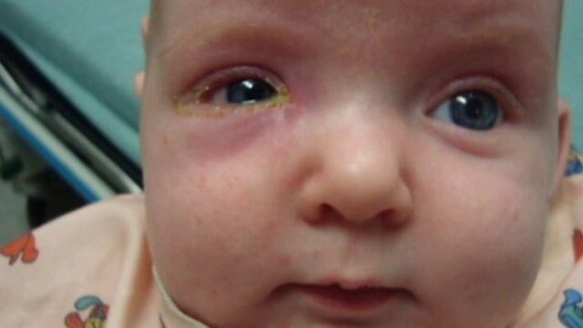 СӘБИДІҢ КӨЗІ БЫЛШЫҚТАНСА НЕ ІСТЕУ КЕРЕК смотреть онлайн