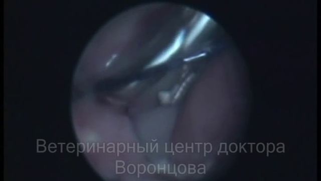 Буллезная болезнь легких смотреть онлайн