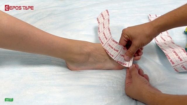 ✅ Ушибы пальцев ног Тейпирование мизинца Тейпирование ноги смотреть онлайн