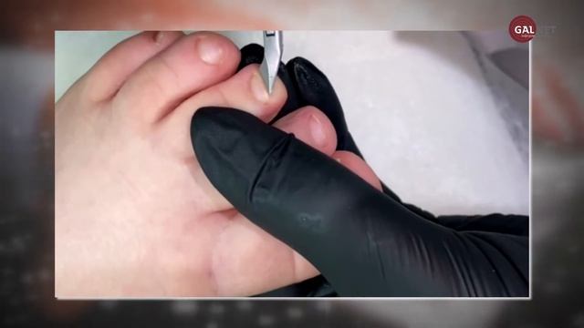 Як правильно обрізати нігті смотреть онлайн