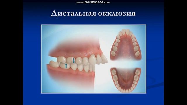 Основные методы лечения аномалий и деформаций смотреть онлайн