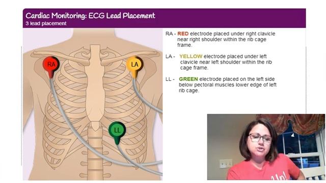 How to place 3 lead EKG смотреть онлайн
