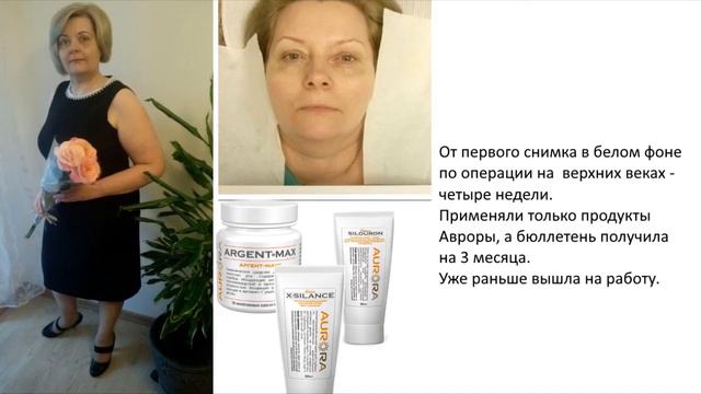 Время молодеть! Аврора в помощь омоложению. Результаты. смотреть онлайн