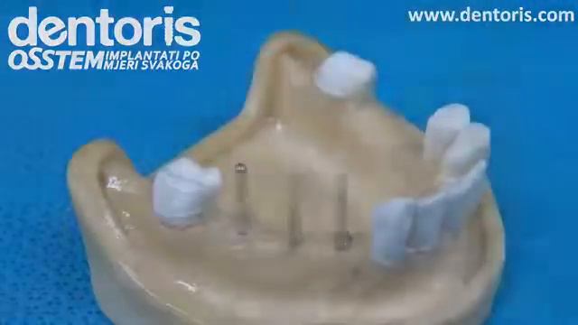 Osstem Implant