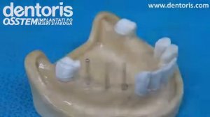 Osstem implant