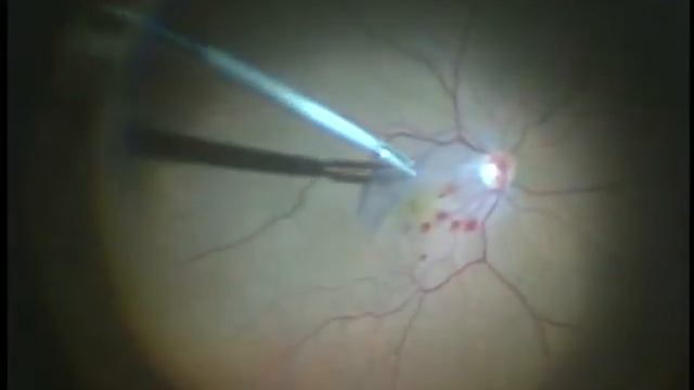 OptiFlex смотреть онлайн