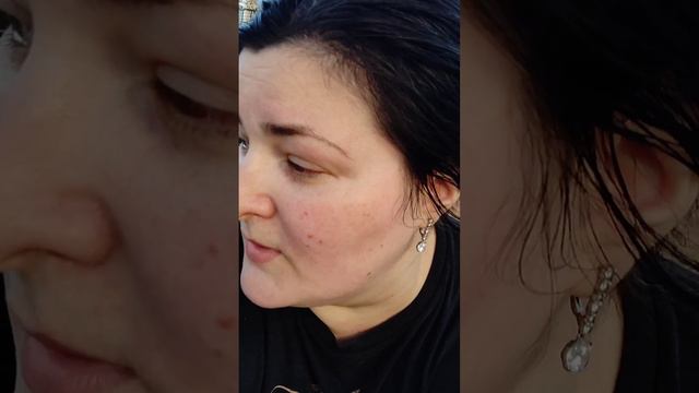 Кровь в глазу. От жары лопаются сосуды. смотреть онлайн