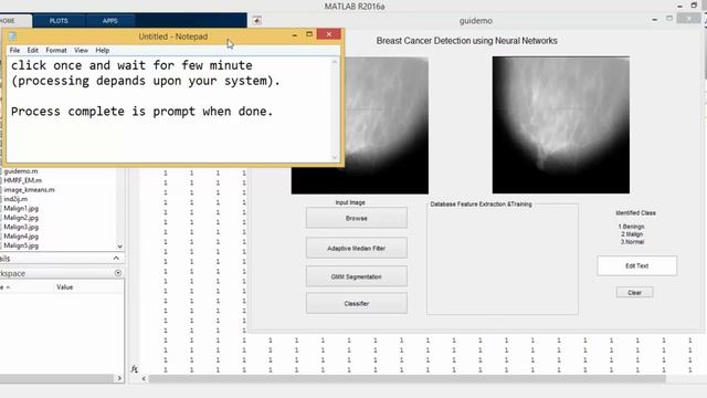 Breast Cencer detection using Median filter, GMM Segmentation and Kmean Classification (Neural Nets смотреть онлайн