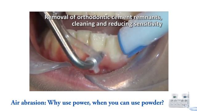 Aquacare for Orthodontists смотреть онлайн