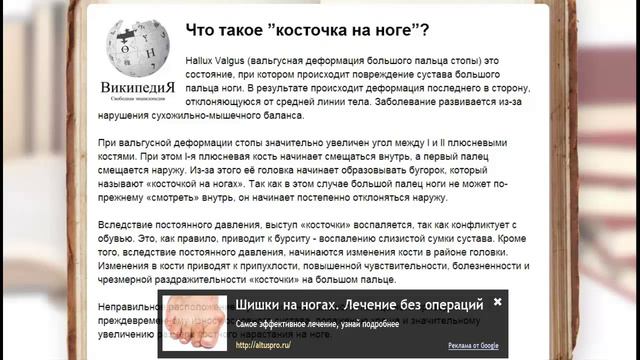 косточки на ногах хирургическое лечение \ имбирь при подагре смотреть онлайн