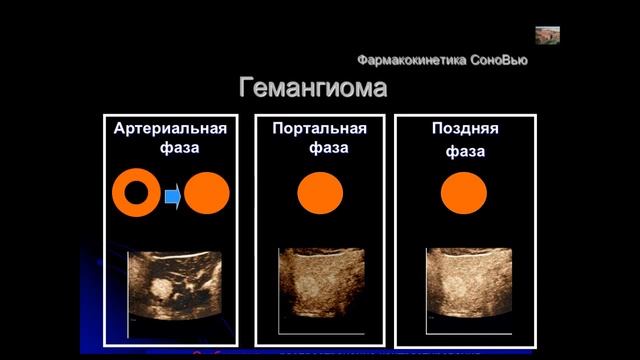 Строкова Л.А. «Aбдоминальное ультразвуковое исследование: искусственное контрастирование» смотреть онлайн