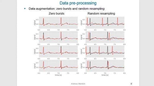 Convolutional neural network for ECG classification смотреть онлайн