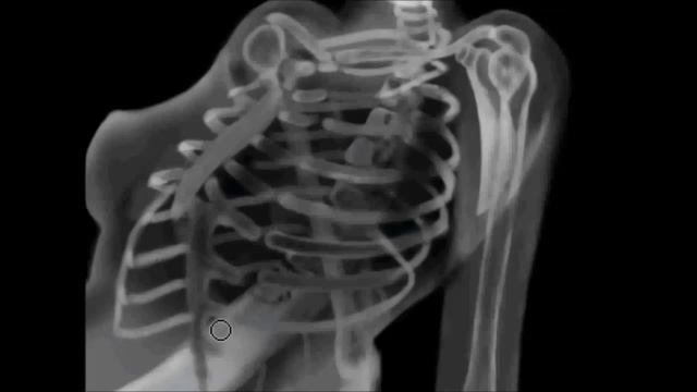 Photoshop drawing process - Girl in x-rays / Рисунок в Фотошоп - Девушка рентген смотреть онлайн