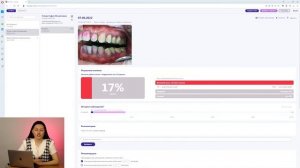 Искусственный интеллект в стоматологии. Как работает программа DIANA