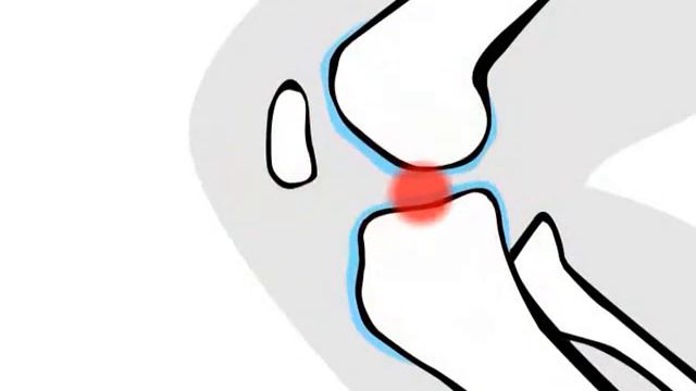 Хондроксид. Скрюченные клерки смотреть онлайн