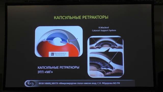 Травма и нестабильность связочного аппарата хрусталика смотреть онлайн