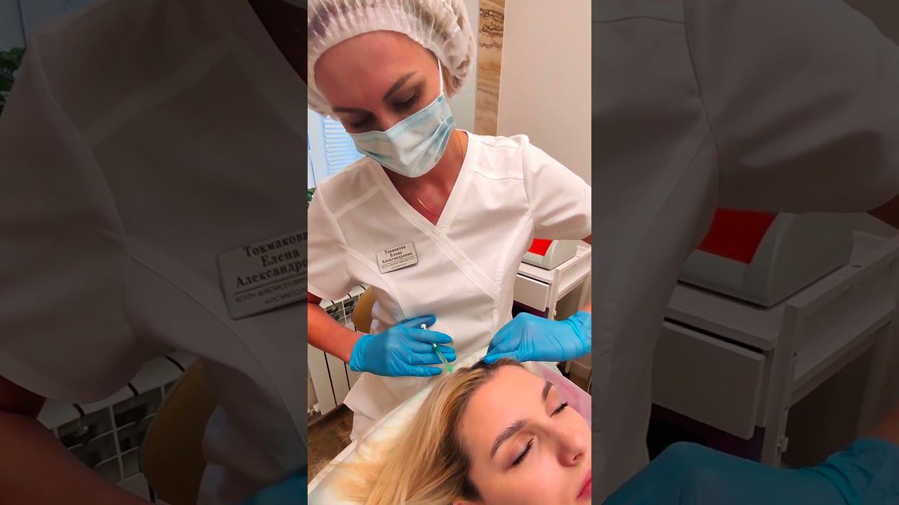 #Мезотерапия | останавливаем выпадение волос смотреть онлайн