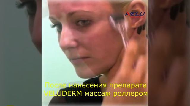 Мезороллер для дома смотреть онлайн