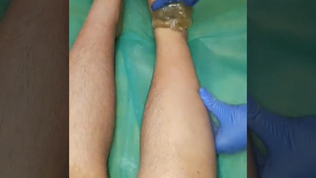 Шугаринг ног смотреть онлайн