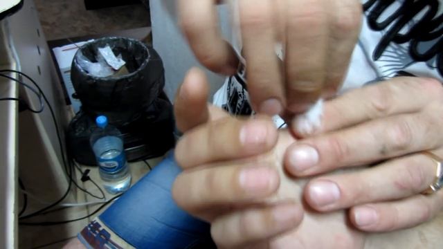 как достать крючок из пальца смотреть онлайн