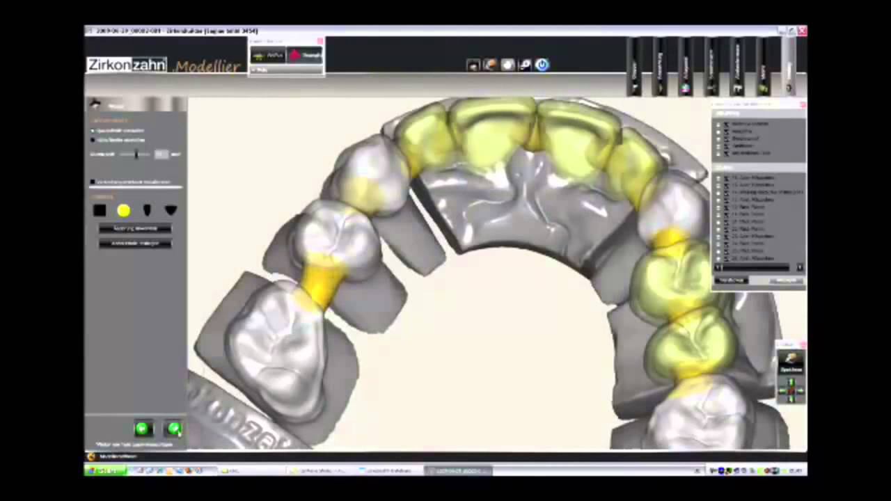 3D проектирование и моделирование зубных конструкций CAD CAM технологии смотреть онлайн