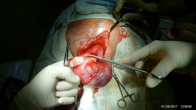 Саркома прямой кишки собаки. Neoplasm of the muscular layer of the rectum of the dog смотреть онлайн