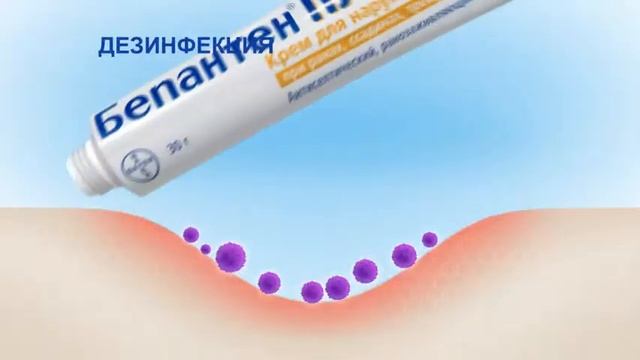 От ран и ссадин смотреть онлайн