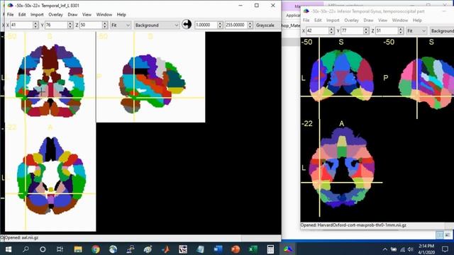 MRIcron Brain Region of Interest (ROI) Guide Part 1 смотреть онлайн