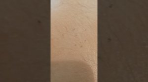 Врачи об этом Вам не скажут! 
Почему ребенок не спит, плачет? Что такое «кочерга» у новорожденных?