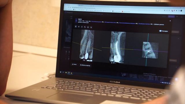 ? Качественная диагностика - залог успешного лечения зубов | Клиника доктора Осиповой смотреть онлайн