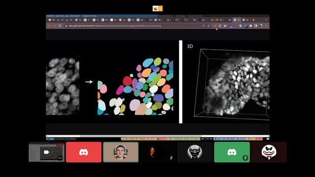 Random Code 9.07.2023. Cell Segmentation. Part 2.|Exploring Cell Segmentation and Classification wi смотреть онлайн