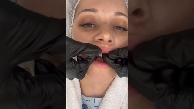 Массаж губ техника. Как делать правильно ✅ смотри и слушай 🫶🏼 смотреть онлайн