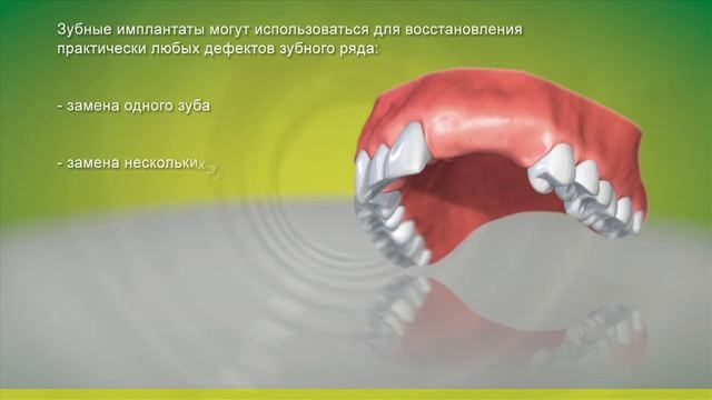 Графический ролик "Красивые зубы" смотреть онлайн