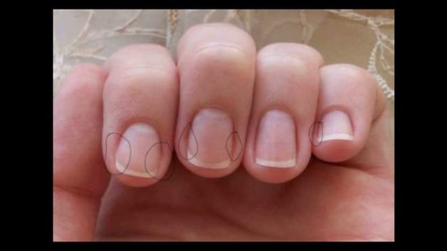 Как избавиться от плохой манеры обгрызать ногти и вырывать заусенцы? смотреть онлайн