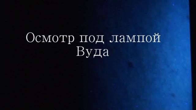 отрубевидный лишай осмотр под лампой Вуда смотреть онлайн