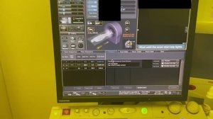 Укладка тазобедренных суставов для компьютерной томографии