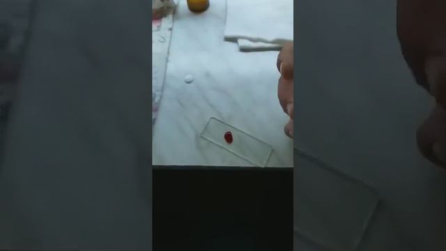 Qon Ivish Vaqtini Aniqlash