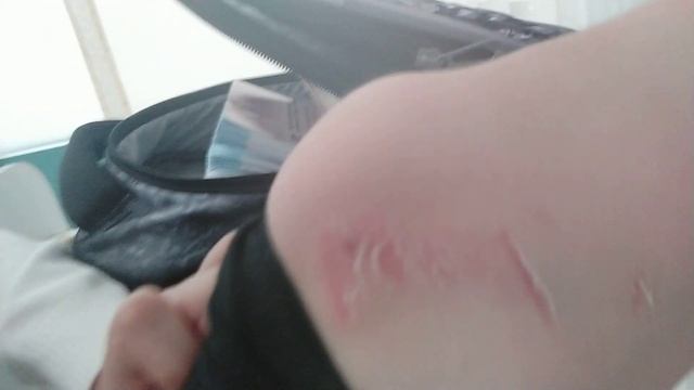 Я упал с лестницы! смотреть онлайн