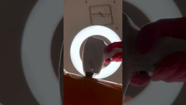 Лазерная эпиляция в #prostolasersbp #лазернаяэпиляция #лазернаяэпиляцияспб #эпиляция #shorts смотреть онлайн