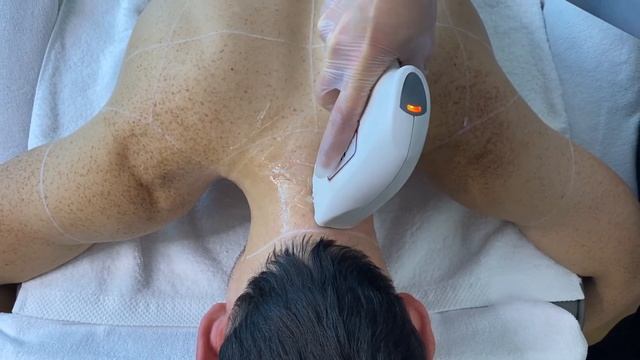 Dauerhafte Haarentfernung TECHNOLOGIEN смотреть онлайн