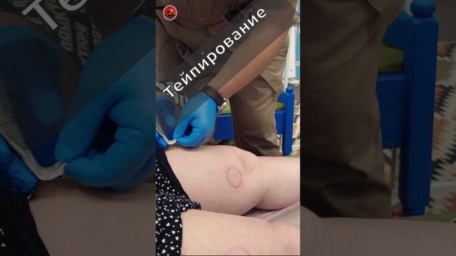 Тейпирование. Профилакатика артроза, боли в суставах. #артрозсуставов #артроз #суставы