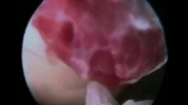 Как происходит овуляция смотреть онлайн