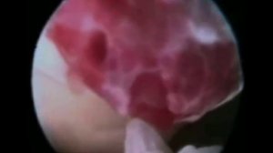 Как происходит овуляция