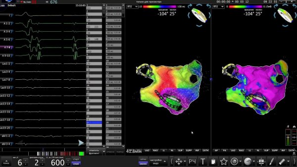 Flow map of left and right flutters