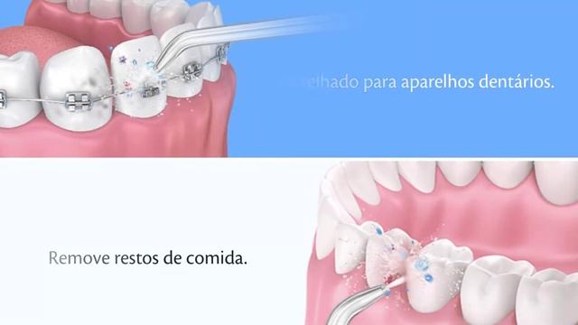 Irrigadores Orais Waterflosser Bionexum смотреть онлайн