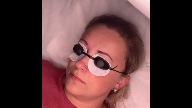 Удаление татуажа лазером. Видео процесса. смотреть онлайн