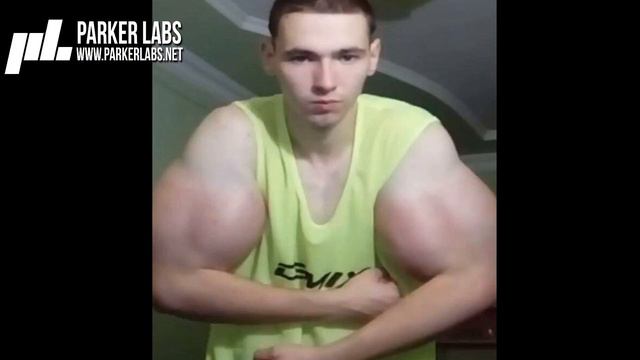 ШОК!!! Генетический монстр или синтольный фрик, Кирилл Терешин - руки-базуки смотреть онлайн